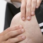 Suppléments alimentaires: un usage limité dans l&rsquo;arthrose