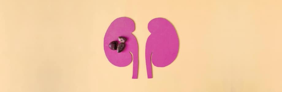 Calculs rénaux: l&rsquo;alimentation a-t-elle une influence?
