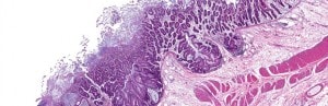 Obésité: la santé dépend du microbiote