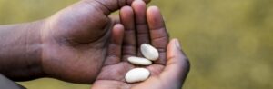 La malnutrition aiguë sévère chez l’enfant: nouvelles directives