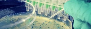 Probiotica: minuscule bacteriën gaan obesitas te lijf