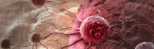 L’obésité, cause mieux connue de cancers