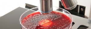 Chaleur et précipitations extrêmes augmentent le risque de salmonellose