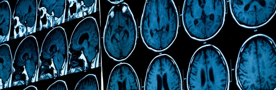 Suiker: waarom het slim is om de consumptie van toegevoegde fructose in het oog te houden
