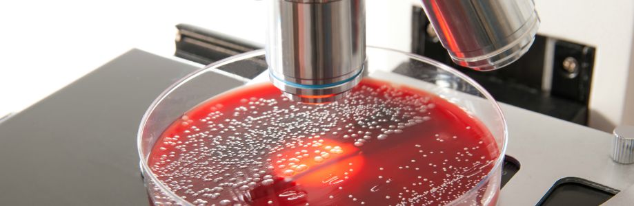 Chaleur et précipitations extrêmes augmentent le risque de salmonellose
