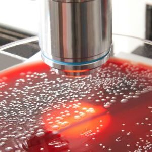 Hitte en extreme neerslag verhogen risico salmonellabesmetting