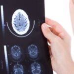 Santé du cœur ou cerveau: faudra-t-il choisir?
