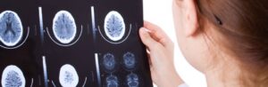 Santé du cœur ou cerveau: faudra-t-il choisir?