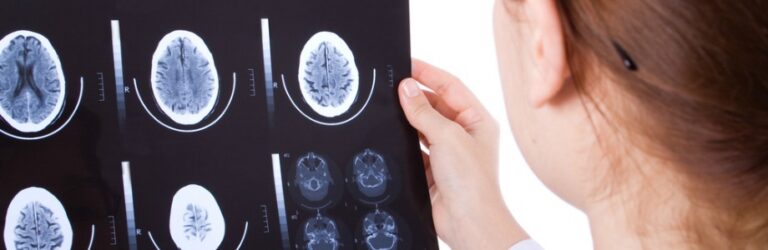 Santé du cœur ou cerveau: faudra-t-il choisir?
