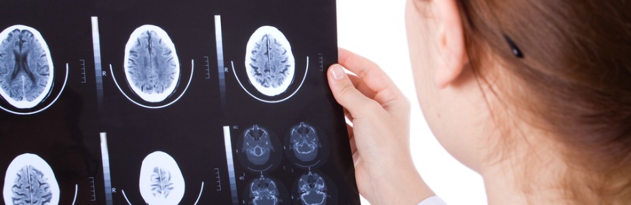 Santé du cœur ou cerveau: faudra-t-il choisir?