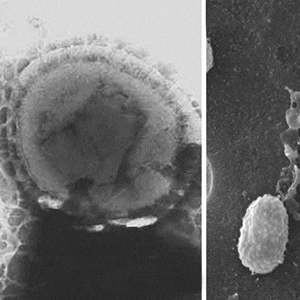 Akkermansia muciniphila: une bactérie intestinale marqueur de bonne santé
