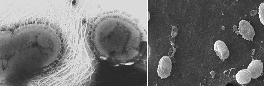 Akkermansia muciniphila: une bactérie intestinale marqueur de bonne santé
