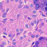Diabète de type 1: régénérer les cellules β