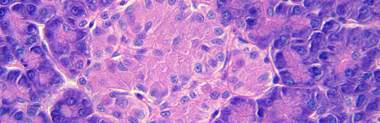 Diabetes type 1: β-cellen regenereren