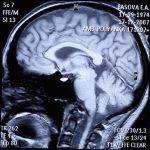 Un centre de motivation identifié dans le cerveau