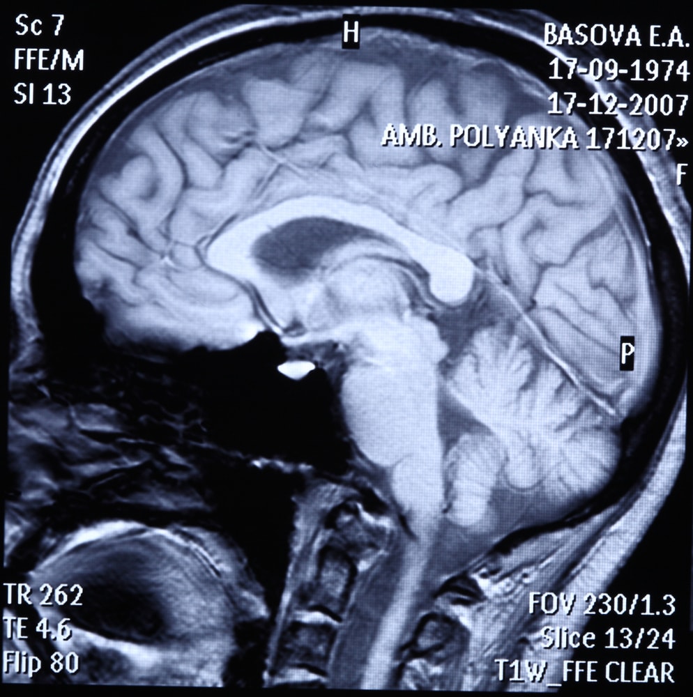 Un centre de motivation identifié dans le cerveau