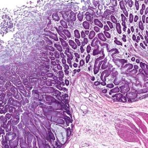 Obésité: la santé dépend du microbiote