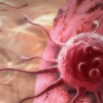 L’obésité, cause mieux connue de cancers