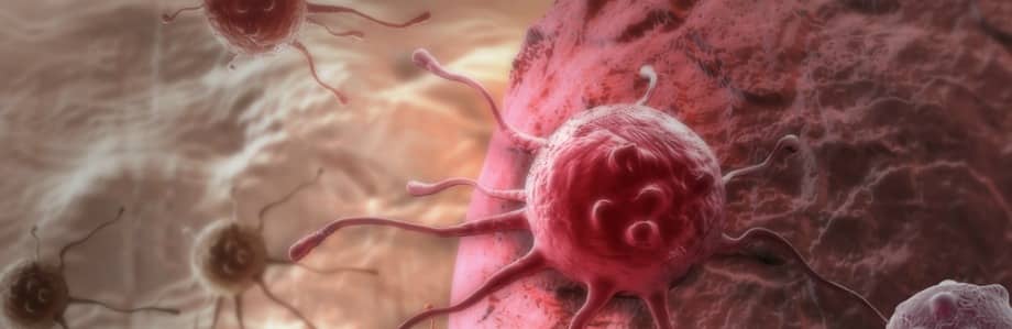 L’obésité, cause mieux connue de cancers