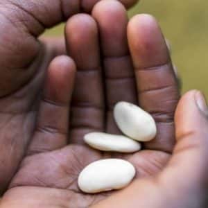 La malnutrition aiguë sévère chez l’enfant: nouvelles directives