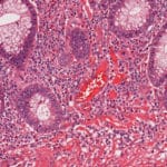 Microbiote intestinal: indispensable au métabolisme du fer