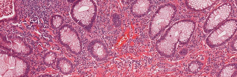 Microbiota in de darm: essentieel voor het ijzermetabolisme