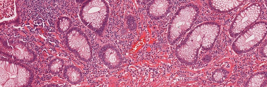 Microbiote intestinal: indispensable au métabolisme du fer