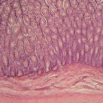 diabete-obesite-microbiote intestinal