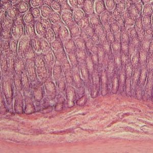 diabete-obesite-microbiote intestinal