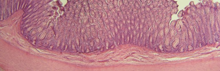 Diabetes en obesitas hebben hun eigen microbiota