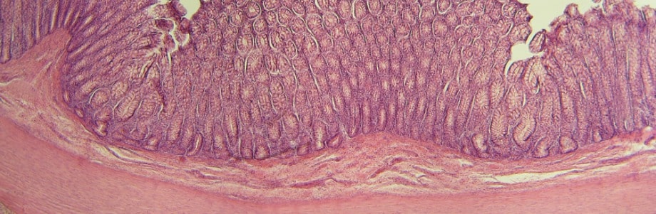 diabete-obesite-microbiote intestinal