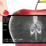 squelette-vitamine d-calcium