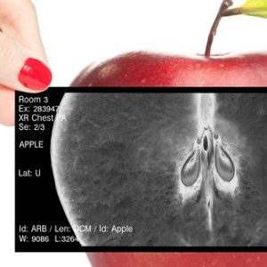 squelette-vitamine d-calcium