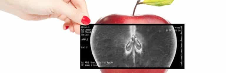Squelette: la vitamine D n’est rien sans calcium