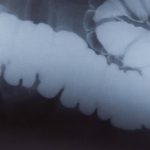 Le microbiome pour les nuls