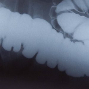 Le microbiome pour les nuls