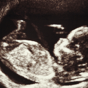 Peut-on prédire le risque de diabète et de maladies cardiaques?
