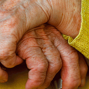 L’obésité aggraverait le risque de maladie d’Alzheimer