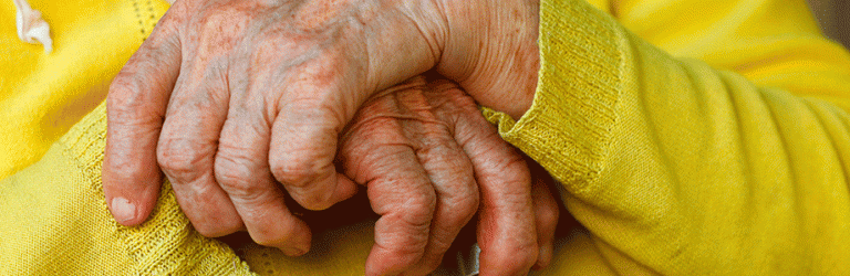L’obésité aggraverait le risque de maladie d’Alzheimer