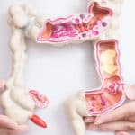 Hoe werkt het FODMAP-dieet?