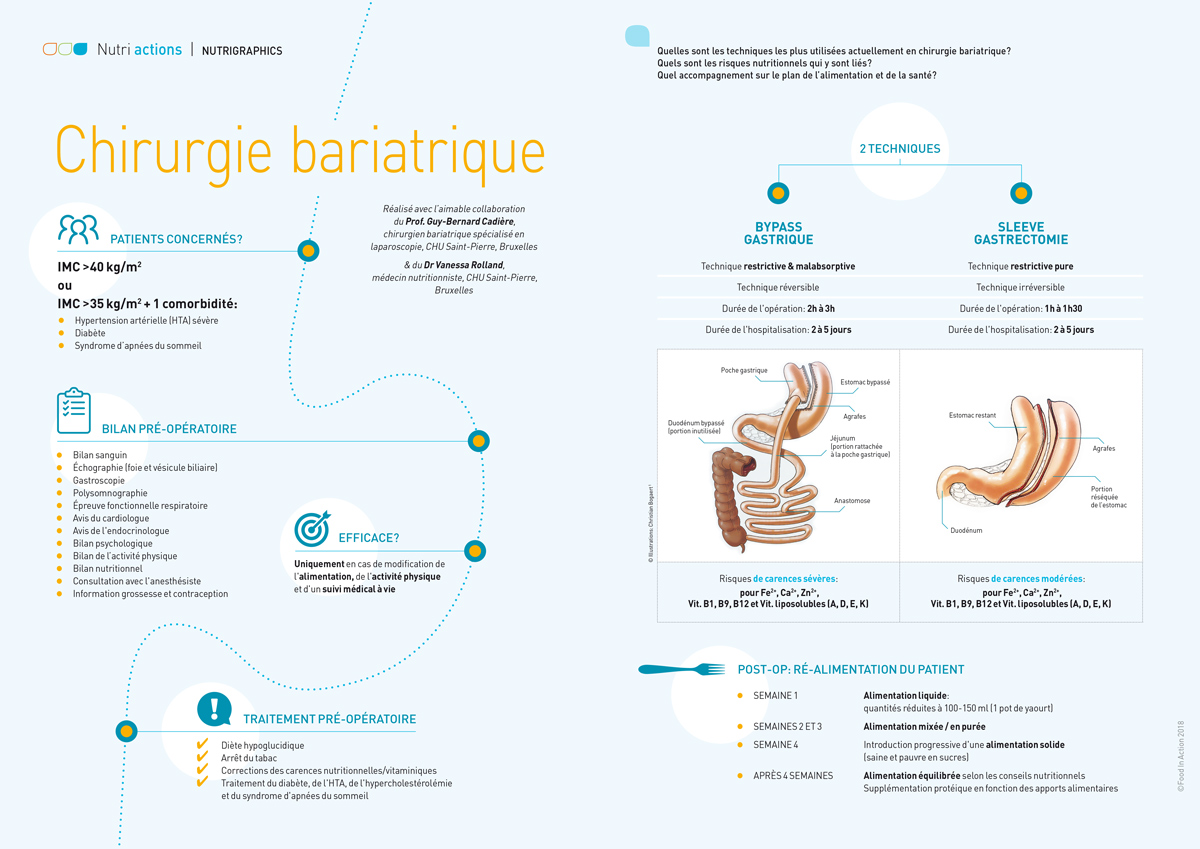 Nutrigraphics: Chirurgie bariatrique