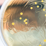 Microbiote et obésité: une signature dans le plasma