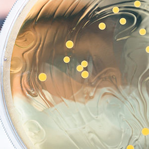 Microbiote et obésité: une signature dans le plasma