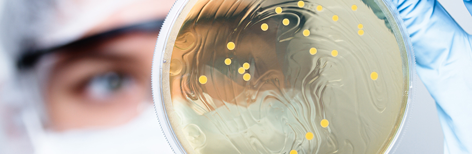 Microbiote et obésité: une signature dans le plasma