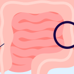 Syndrome de l&rsquo;intestin irritable : les bons gestes