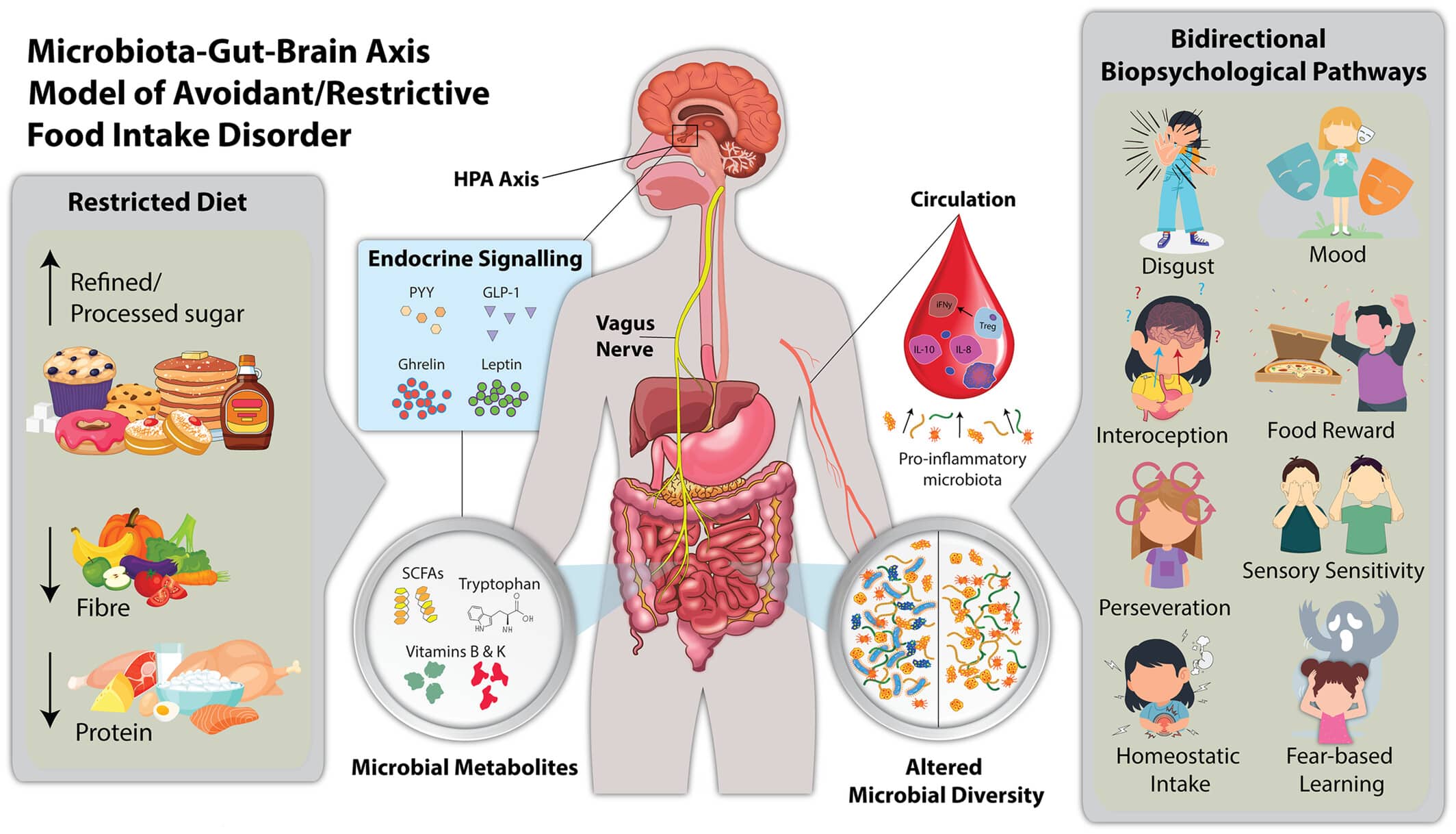 ARFID : le microbiote impliqué dans ce trouble du comportement alimentaire ?